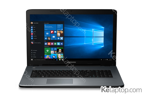 MEDION AKOYA P7645-i5-1128 Ausstattung MEDION AKOYA P7645-i5-1128 Ausstattung